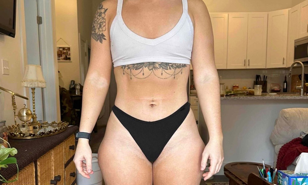 After Transformation 1