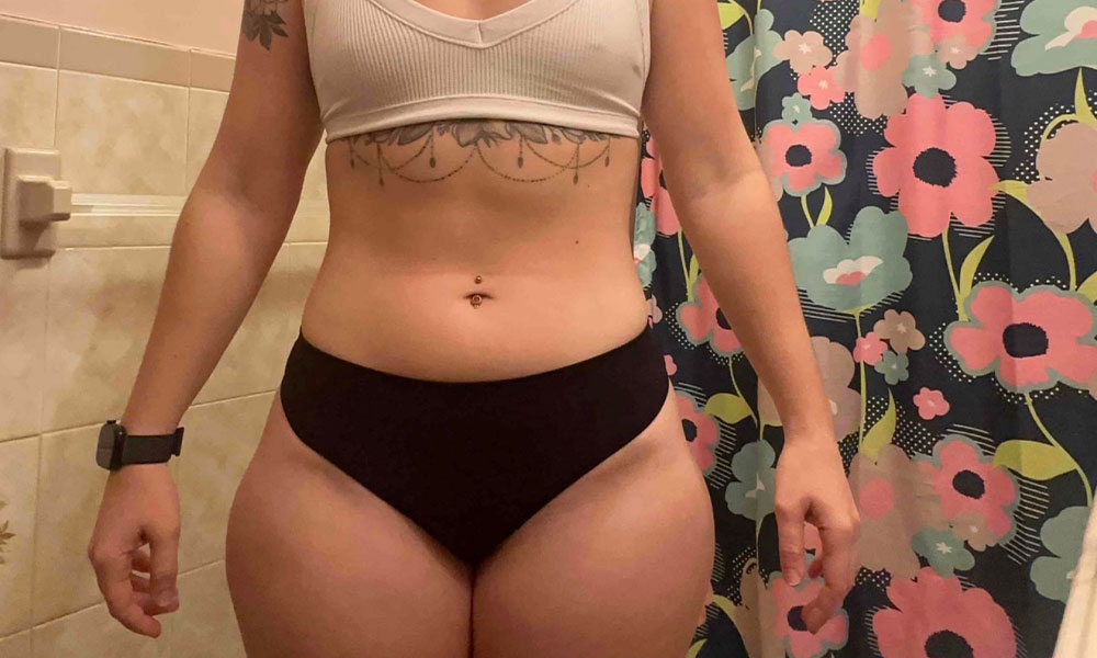 Before Transformation 1